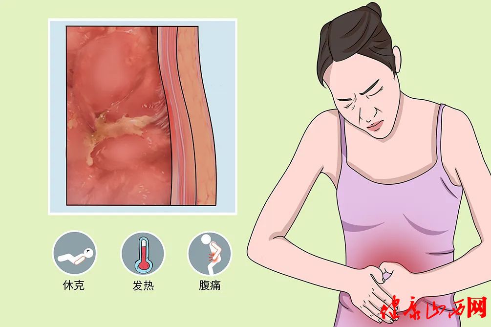 什么是腹膜透析相关性腹膜炎？