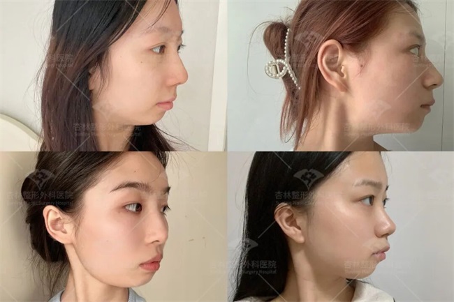 这三种特征不仅“显土气”还会“显脸胖”杏林改脸型(图3)