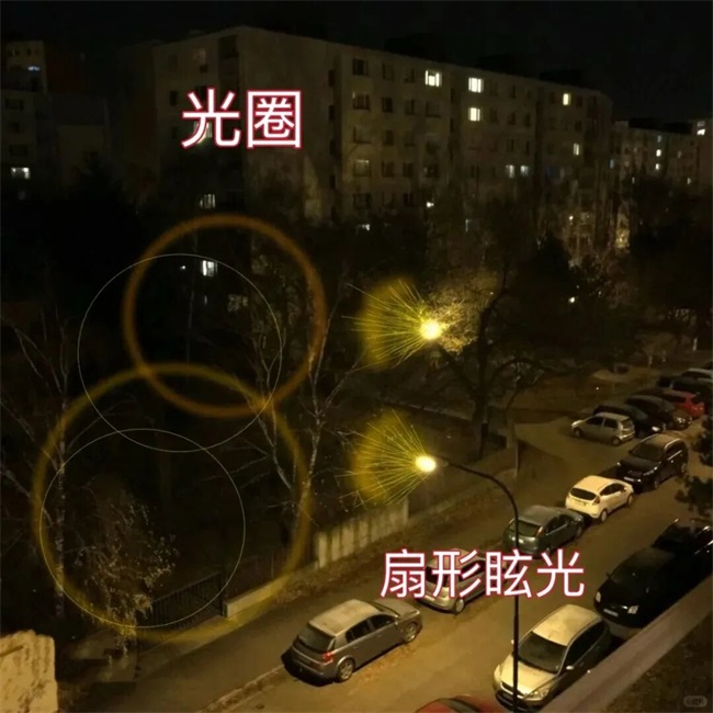 郑州近视手术术后眩光超全解答——尖峰眼科(图1) 郑州近视手术术后眩光超全解答——尖峰眼科(图1)