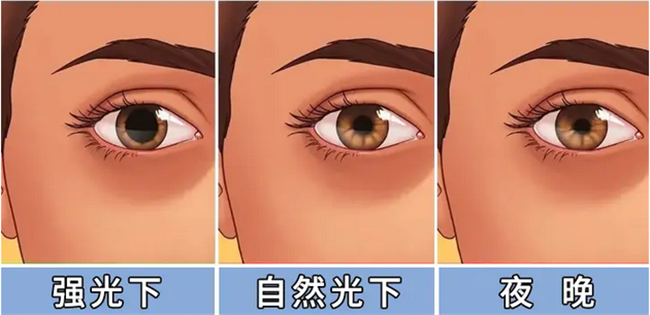 郑州近视手术术后眩光超全解答——尖峰眼科(图6) 郑州近视手术术后眩光超全解答——尖峰眼科(图6)